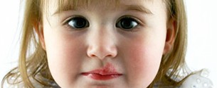 Лечение герпесвирусной инфекции у детей