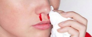 Лечение носовых кровотечений