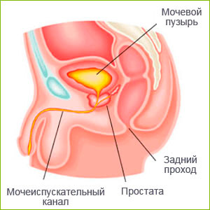 Диагностика рака предстательной железы