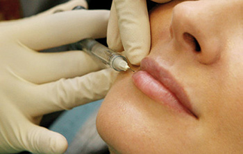 Увеличение губ без операции гиалуроновой кислотой