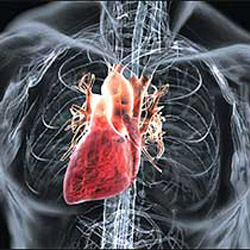 Постинфарктный кардиосклероз