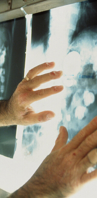 Рак предстательной железы: диагностика и лечение